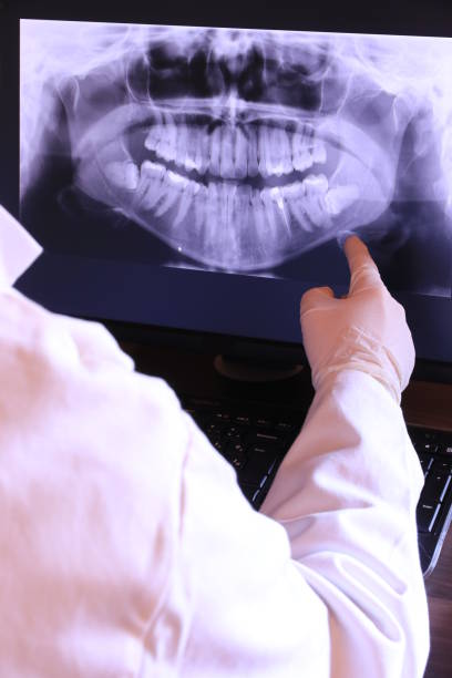 Best Emergency Root Canal Therapy in Beachwood, NJ